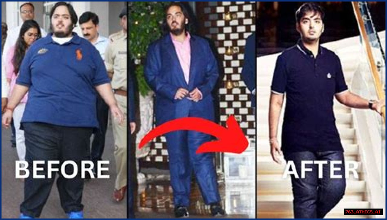 Anant Ambani's Health Journey: Is His Disease Curable Or Not?