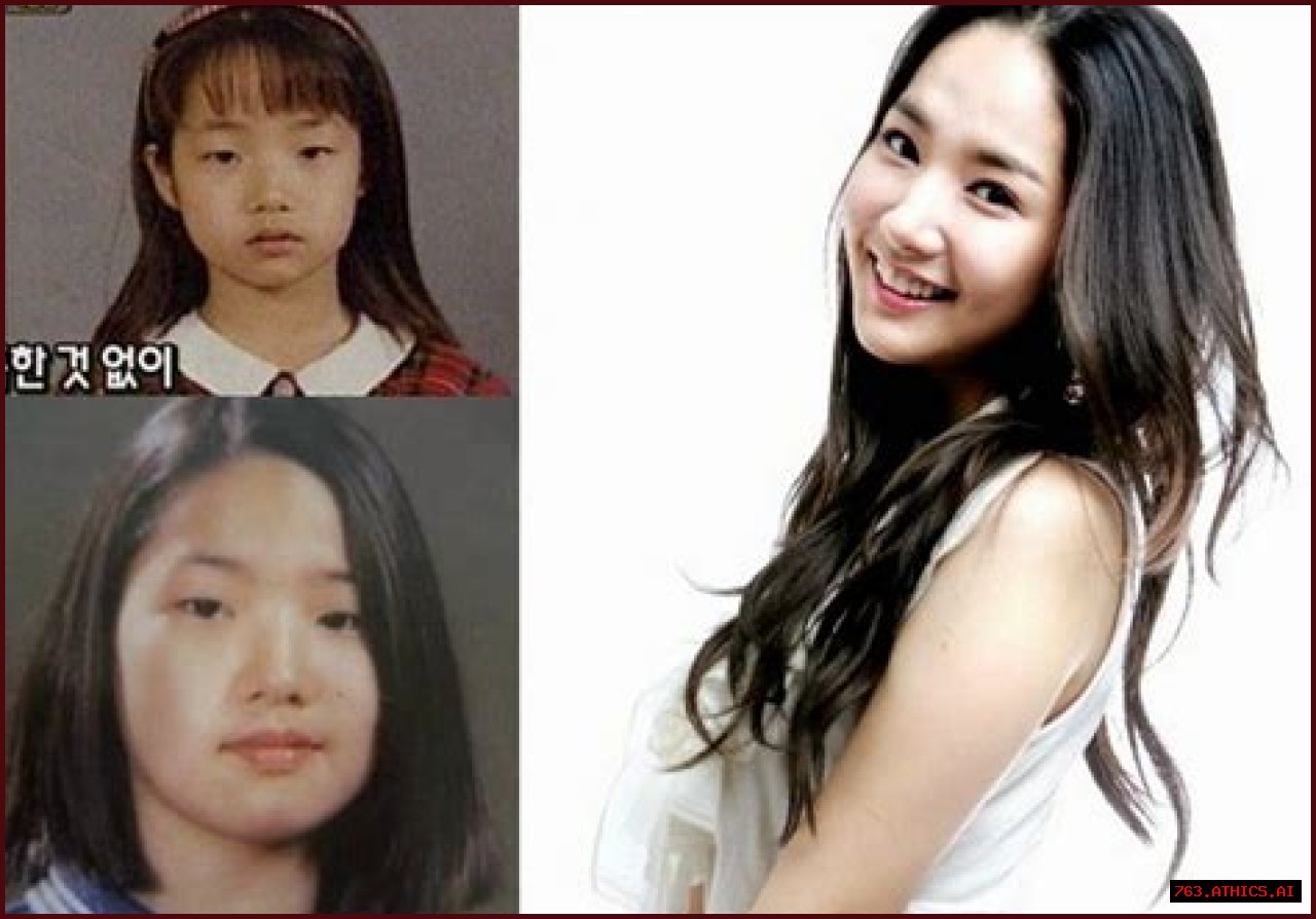 Park Min Young's Transformation: Uncovering The Journey Before Surgery