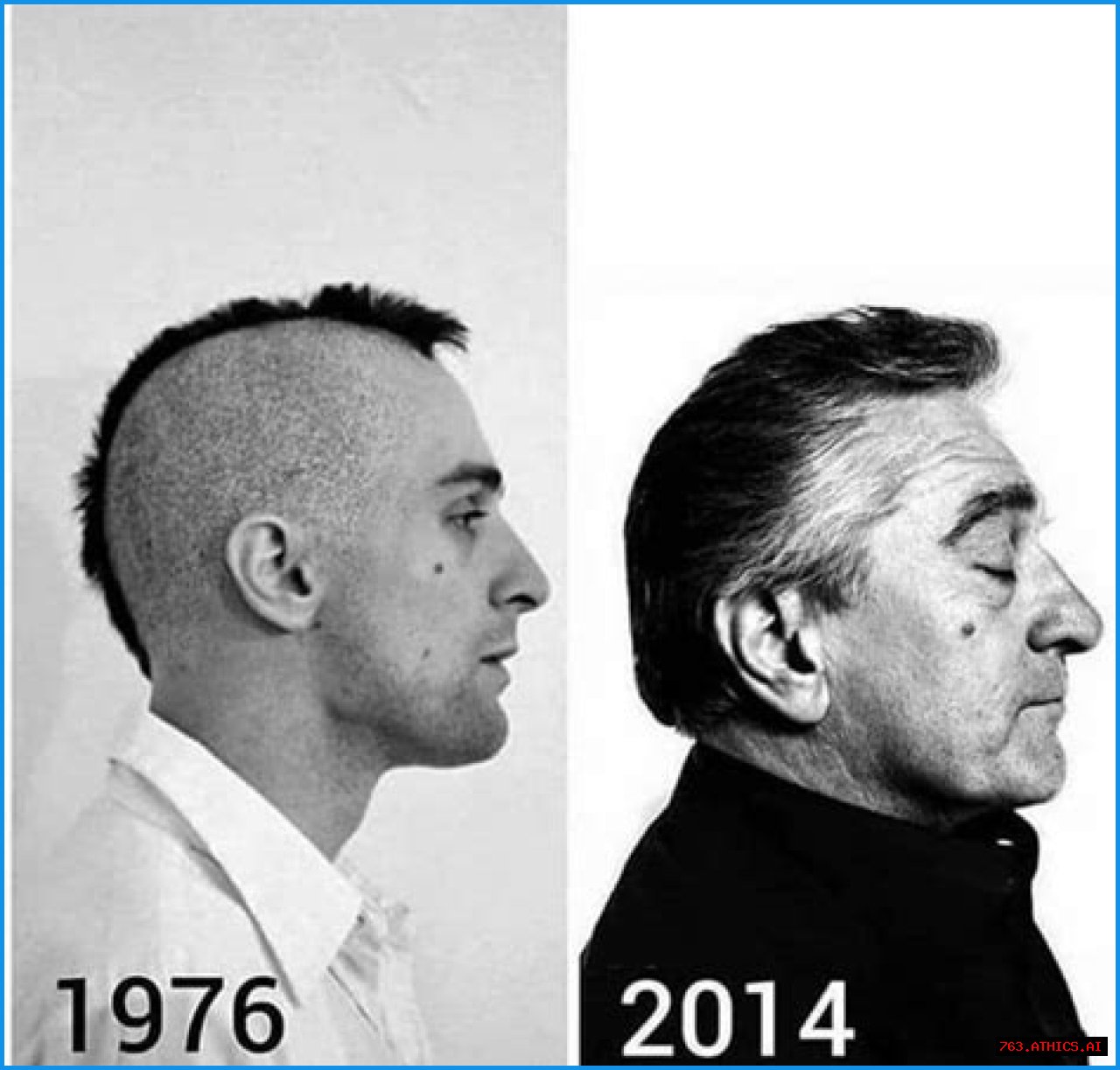 Understanding The De Niro Ear: A Comprehensive Guide